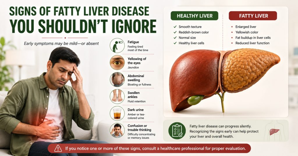 Signs of fatty liver disease, including fatigue, upper-right abdominal discomfort, jaundice, swelling, dark urine, and confusion