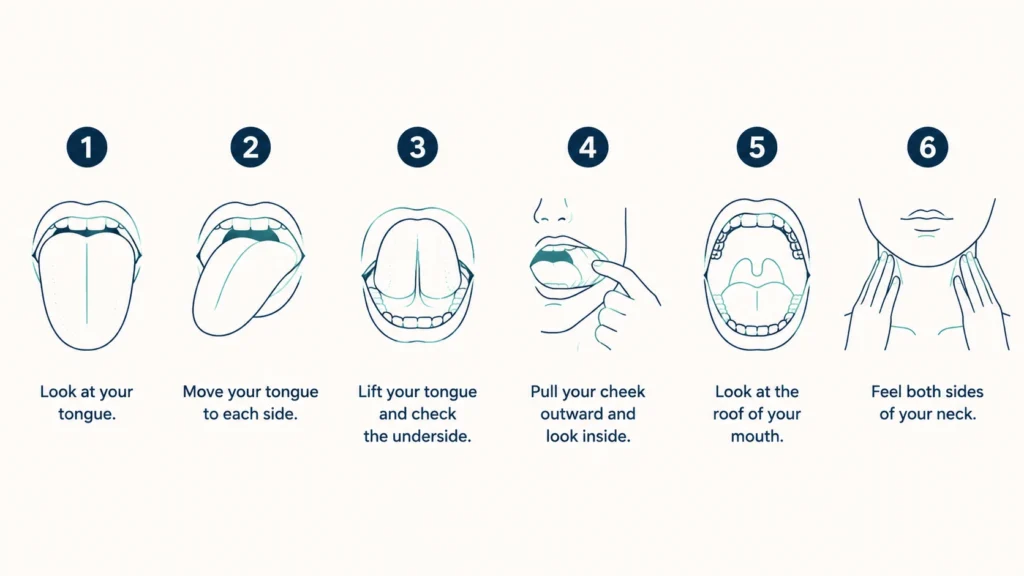 Six step guide showing how to check your tongue, cheeks, roof of mouth and neck during a monthly self exam